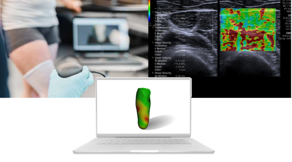 Zum Artikel "Mobiles, haptisches Scanverfahren für die optimierte Erfassung von Gewebeeigenschaften in der Orthopädietechnik"