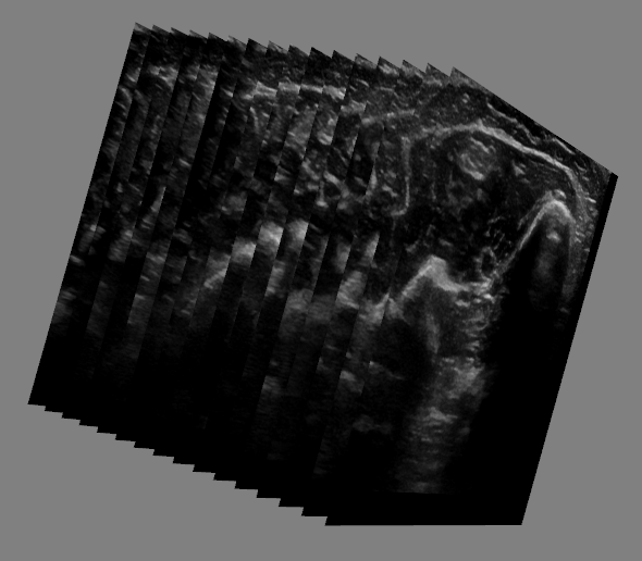 Zum Artikel "Entwicklung eines Low-Cost-Systems zur 3D-Rekonstruktion von Ultraschallbildern"