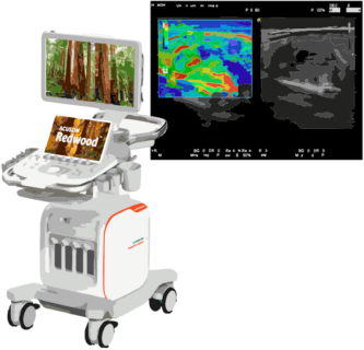 Zum Artikel "Entwicklung einer GUI zur automatisierten Verarbeitung und 3D-Rekonstruktion von Ultraschall- und Elastographiebildern"