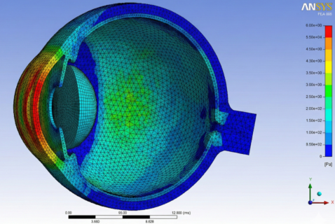 Zum Artikel "Biomechanische FEM-Simulation des menschlichen Auges unter akustischer Anregung"